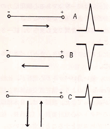 総局誘導軸におけるベクトルの方向と心電図波形との関係