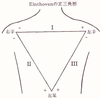 Einthovenの正三角形模型