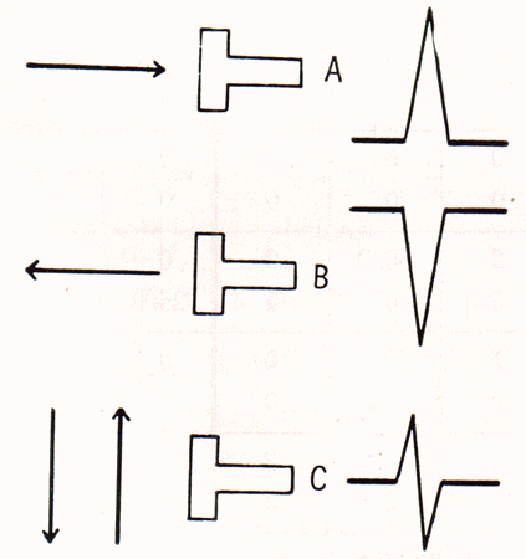 単極誘導におけるベクトルの方向と心電図波形との関係