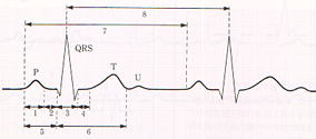 正常心電図の模型図と時間間隔の測定